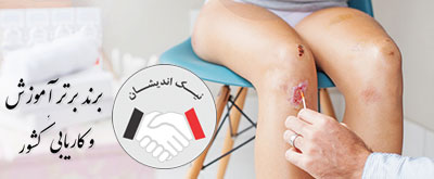 دبریدمان زخم